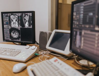 Medical imaging setup with MRI scans on multiple screens in a healthcare facility.