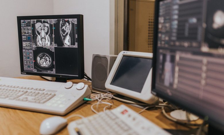 Medical imaging setup with MRI scans on multiple screens in a healthcare facility.